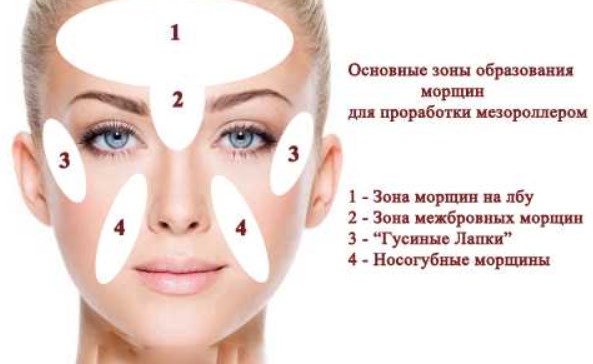 image_1
